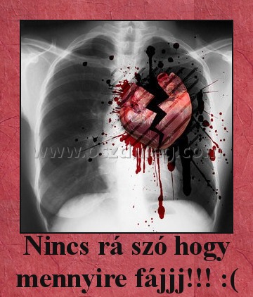 Nincs rá szó hogy mennyire fájjj!!! :(
 
